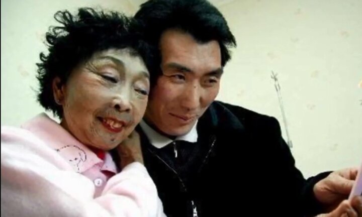 Cụ bà 71 tuổi 'dao kéo' để xứng đôi với chồng 37 tuổi và cái kết bất ngờ