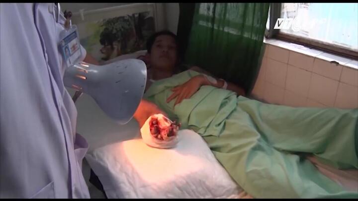 Xót lòng những đứa trẻ lăn lộn mưu sinh, mất đi một phần thân thể vì tai nạn lao động