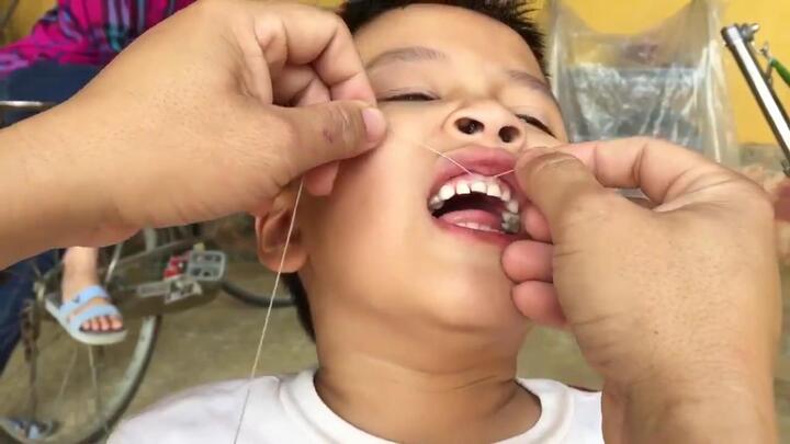 Bố dùng xe máy nhổ răng cho con trai khiến dân mạng 'cười chảy nước mắt'
