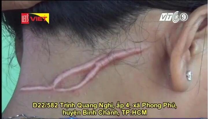 Bị hàng xóm vô cớ dùng dao cứa cổ, người phụ nữ phải sống trong sợ hãi