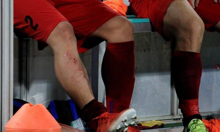 Cầu thủ Hải Phòng đau chảy nước mắt, chân rớm máu sau cú đạp của Sầm Ngọc Đức