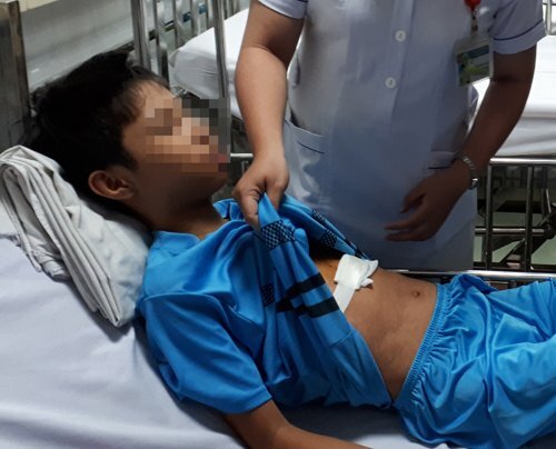 Mổ cấp cứu cho bé trai bị kim đâm trúng vào lồng ngực