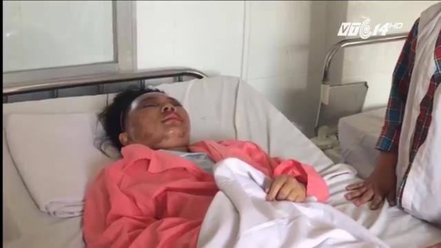 Cãi nhau với hàng xóm, cả nhà bị tạt axit: Cô gái 23 tuổi có nguy cơ bị mù