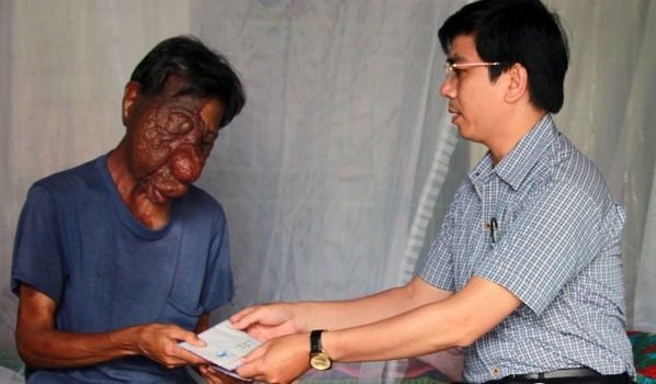 Người mang khuôn mặt dị dạng rưng rưng nhận món quà nghĩa tình từ bạn đọc VTC News