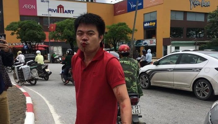 Va chạm giao thông, lái xe ô tô bị đánh chảy máu vùng mặt