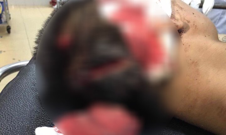 Đoàn quân côn đồ mang súng, dao kiếm truy sát kinh hoàng làng quê Hải Dương như chốn vô pháp luật