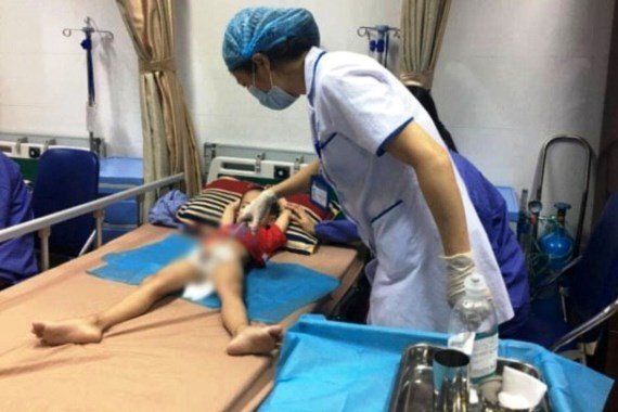 Trẻ bị lây sùi mào gà ở Hưng Yên: Điều tra dịch tễ tại 25 xã, thị trấn