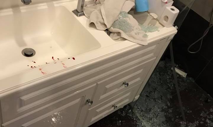 Kinh hoàng cảnh kính cường lực phát nổ, găm đầy người như 'đạn hoa cải'