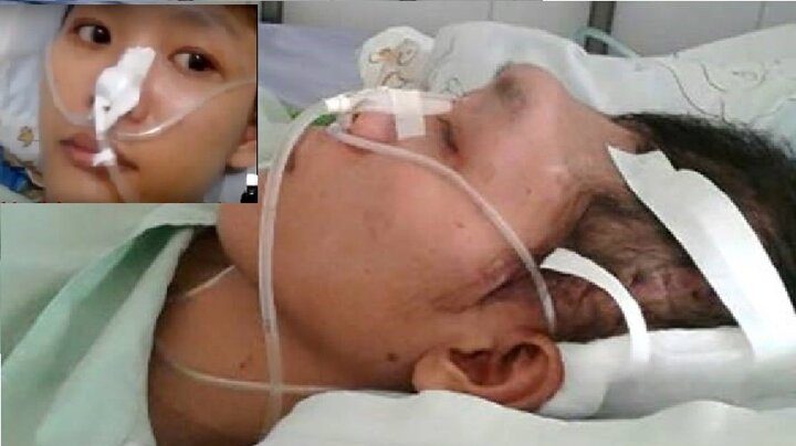 Những bệnh nhân tai nạn giao thông vỡ sọ phục hồi kỳ diệu bởi lọ thuốc trị tai biến thần kỳ