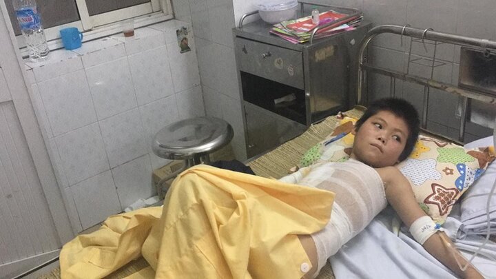 Video: Bạn ép trèo cột điện, cháu bé người Mông bị điện giật suýt chết