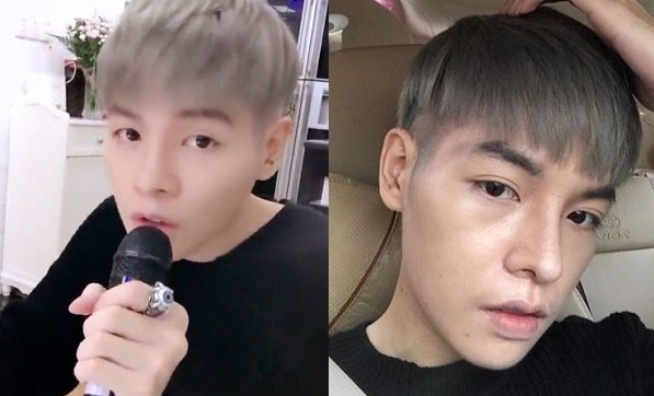 Cận cảnh gương mặt nam thần của Đức Phúc sau phẫu thuật thẩm mỹ