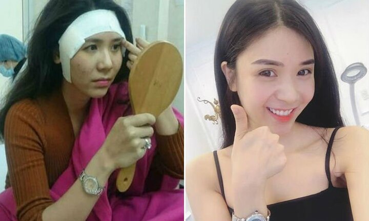 Phủ nhận phẫu thuật thẩm mỹ, Thanh Bi 'Người phán xử' bị tung ảnh 'đập mặt xây lại'