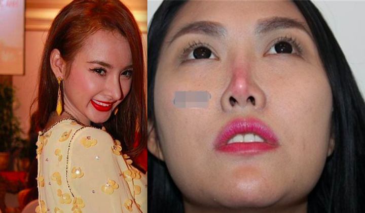 Video: Hàng loạt sao Việt hứng chịu hậu quả thẩm mỹ do dao kéo