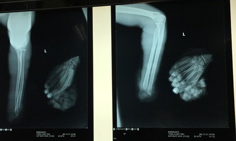 Lao động bất cẩn, thanh niên bị máy xén giấy cắt lìa tay