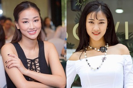 Vì đâu 'sao' Việt đua nhau công khai phẫu thuật thẩm mỹ?