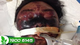 Ăn lòng lợn, mắc liên cầu lợn suýt chết