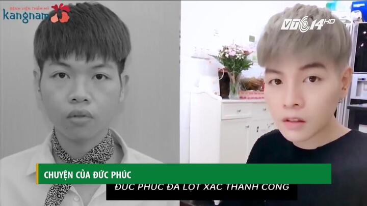 Đức Phúc trải lòng về hành trình 'vịt hóa thiên nga' nhờ phẫu thuật thẩm mỹ