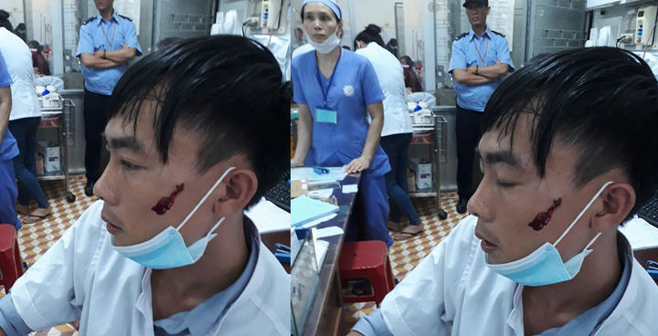 Nam điều dưỡng bệnh viện bị người nhà bệnh nhân đánh rách mặt
