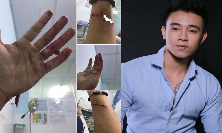 Top 3 Vietnam Idol bị chủ nợ của mẹ chém rách tay