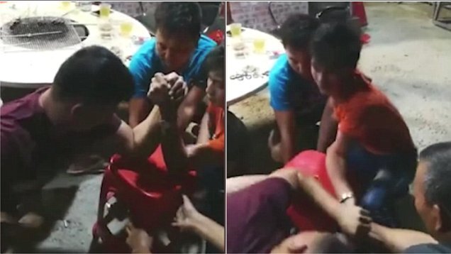 Khiếp đảm clip gãy xương răng rắc khi vật tay với bạn nhậu