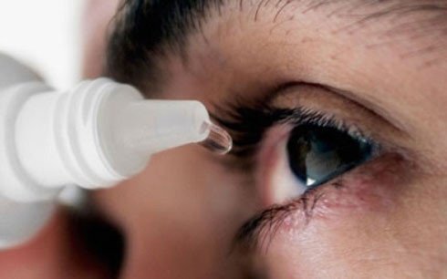 Cần làm gì khi mùa đau mắt đỏ đang tới?