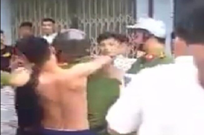 Đại uý công an bị 5 thanh niên đánh thương tích ở Bình Dương