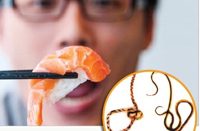 Bệnh nhiễm giun sán và những điều cần biết để phòng tránh trước khi quá muộn