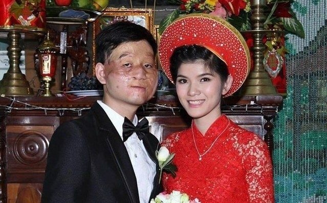 Điểm mặt những đám cưới 'lệch pha' khiến ai nấy đều xúc động vì tình yêu chân thành