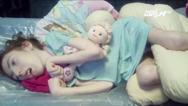 Bé gái tật nguyền suốt đời vì nụ hôn 'tử thần' của mẹ