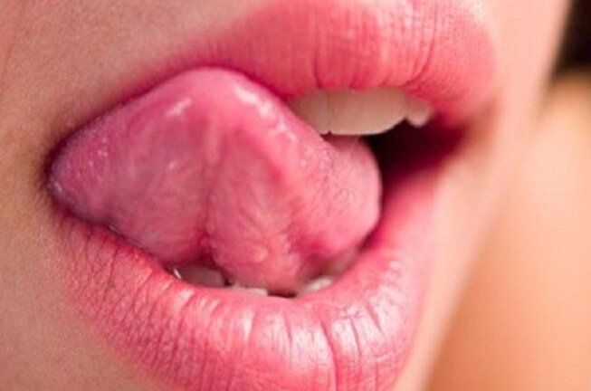 Bệnh lạ: Thấy vị ngọt trong miệng mỗi khi nghe tên sếp
