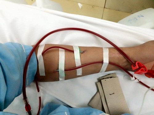 Kinh hoàng: 75% mẫu nước dùng cho chạy thận không đủ tiêu chuẩn