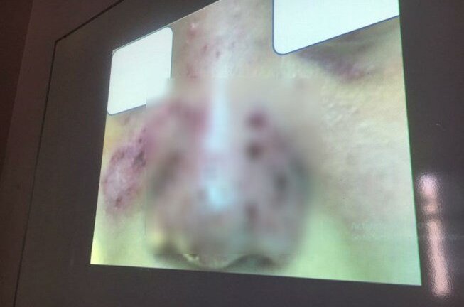 ​Thẩm mỹ chui ở chung cư, bỏ 1 đồng trả giá gấp 10 lần