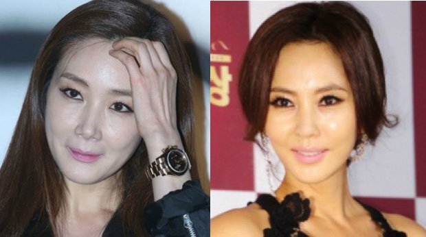 Không thể nhận ra Choi Ji Woo, Kim Nam Joo lão hoá quá nhanh, xuống sắc trầm trọng