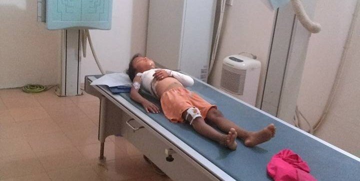 Phụ huynh 'tố' nhà trường thờ ơ khi học sinh bị cửa sắt đè gãy xương: Hiệu trưởng lên tiếng