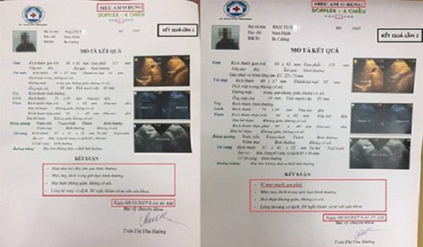 Bệnh viện 16A Hà Đông: Một bệnh nhân đi khám, hai kết quả khác nhau