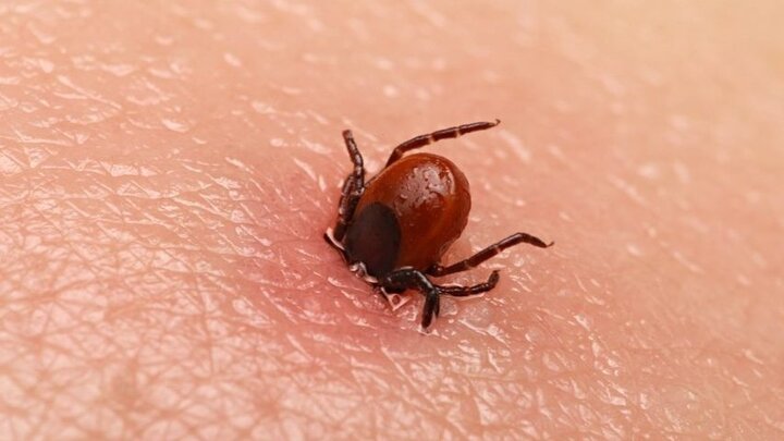 Bị ve cắn từ 16 năm trước, cô gái liệt người, mất trí nhớ