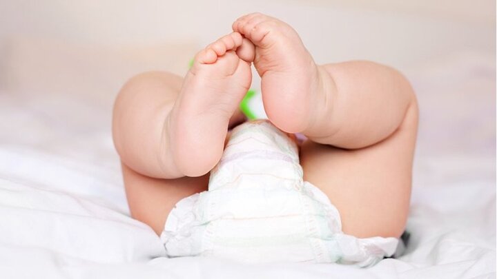 Bố mẹ lười thay bỉm, bé 10 tháng tuổi mắc sỏi thận