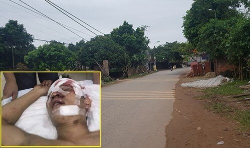 Nhóm côn đồ truy sát 2 thanh niên trong quán bia ở Hà Nội