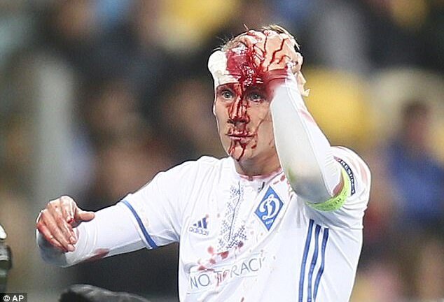 Cầu thủ vỡ đầu, đổ máu ghê rợn vẫn không chịu rời sân