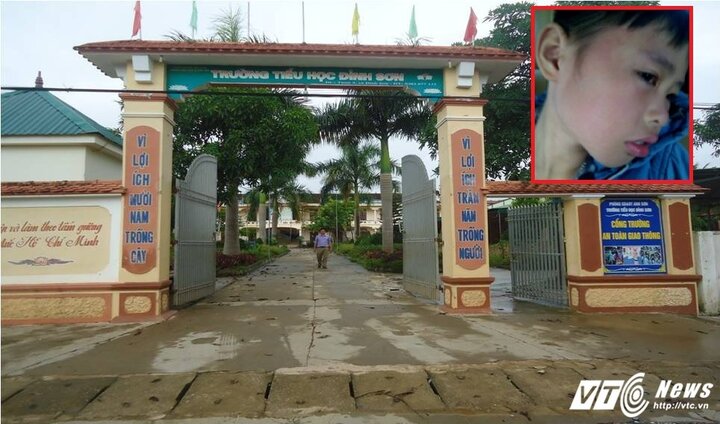 Phụ huynh đánh hiệu trưởng nhập viện: Sở GD&ĐT Nghệ An yêu cầu xử lý nghiêm