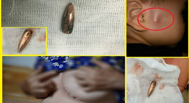 Đạn lạc 5 lần trong 4 tháng: Giám đốc Công an tỉnh Vĩnh Phúc lên tiếng