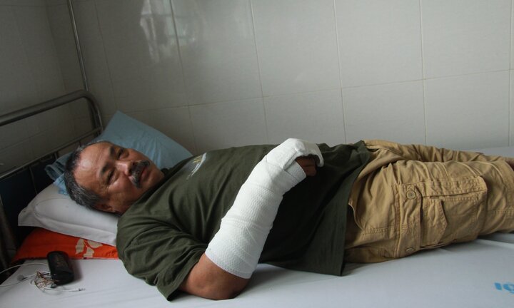 Bị phát hiện, kẻ trộm dùng hung khí tấn công chủ nhà nhập viện