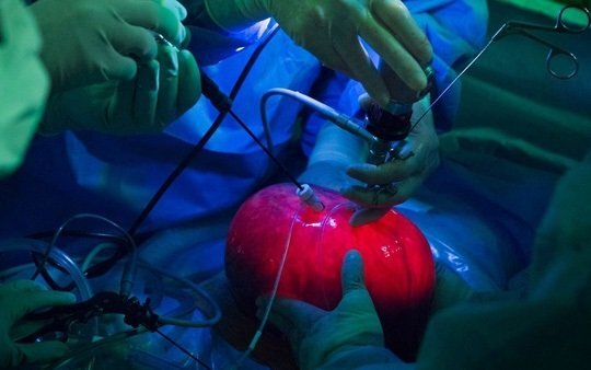 Kỳ lạ ca mổ lấy tử cung ra khỏi bụng mẹ để chữa bệnh cho thai nhi