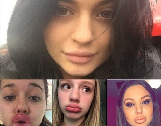 Đôi môi tều của tân Hoa hậu Đại dương là xu hướng 'hot' cách đây 2 năm