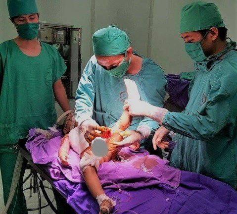 Bị nước sôi đổ vào người, bé trai 2 tuổi lột từng mảng da từ ngực đến chân