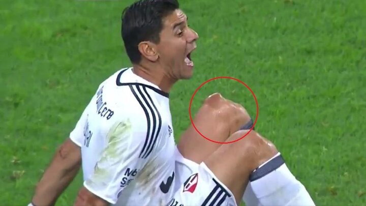 Thủ môn ôm gối khóc òa trên sân sau chấn thương khủng khiếp