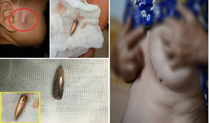 Phó Thủ tướng chỉ đạo làm rõ vụ đạn lạc 5 lần trong 4 tháng ở Vĩnh Phúc