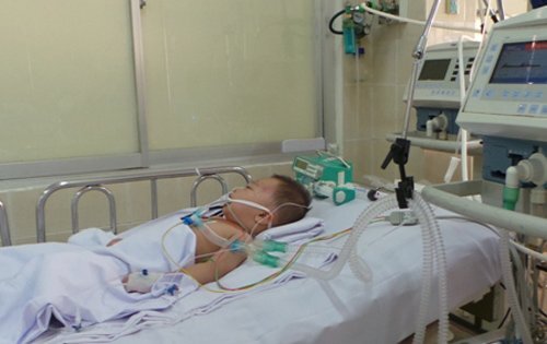 Đồng Nai: Mổ xuyên đêm cứu sống bé 2 tuổi bị xe tải tông chấn thương não