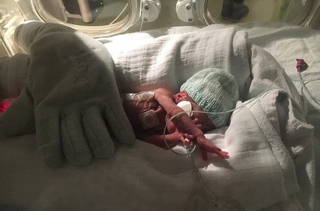 Bé trai sinh non chỉ nặng hơn 4 lạng, nhỏ bằng bàn tay sống sót kỳ diệu