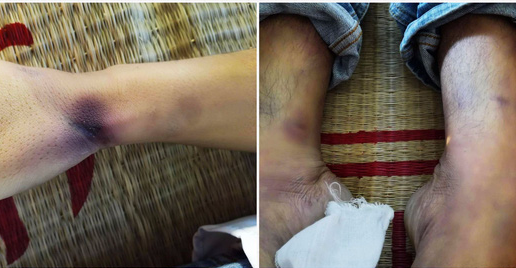 Nam thanh niên chết bất thường sau khi bị công an bắt